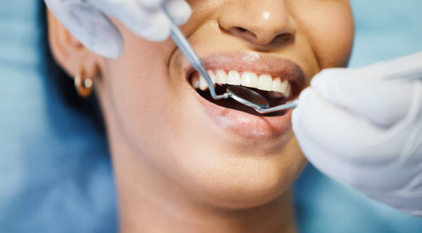 Best Teeth Whitening  in Mountain Park, GA