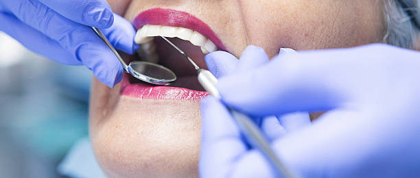 Best Knocked-Out Tooth Emergency  in Mountain Park, GA